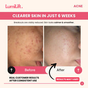 GlowLUXE™, Clinic-Grade LED Therapy at Home